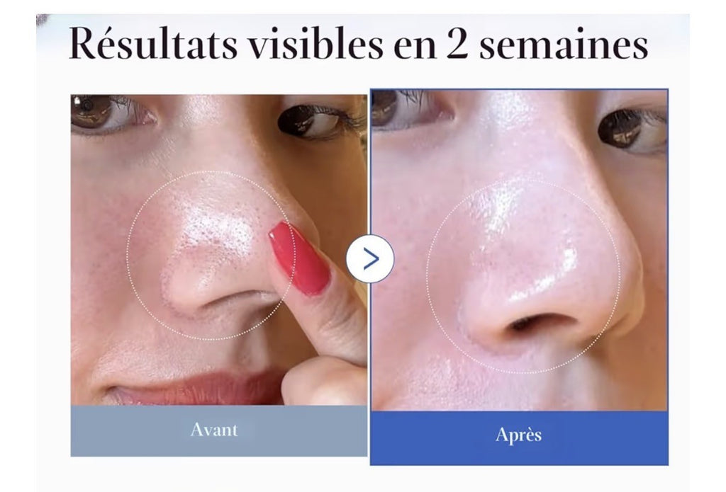 Tampons tonifiants pour le visage à double texture